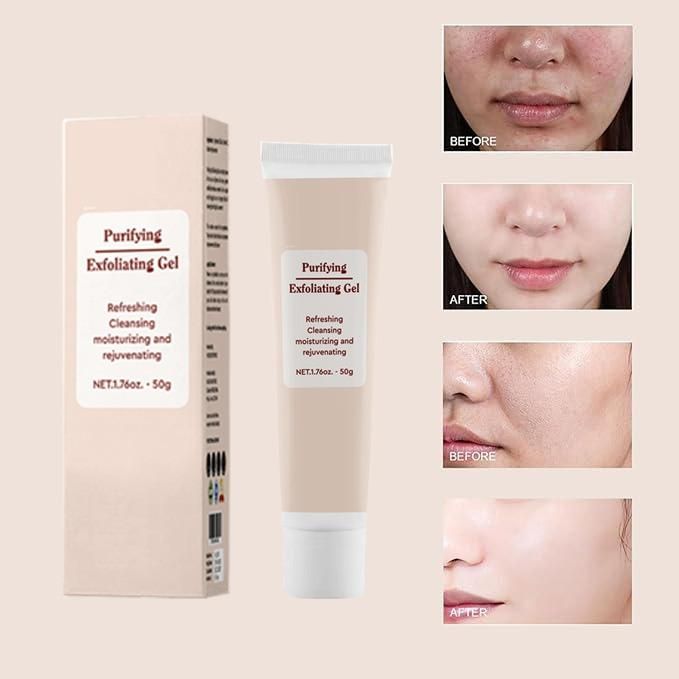 Purifying Exfoliating Gel 100g Pack of 2